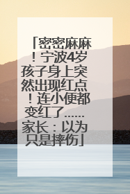 密密麻麻！宁波4岁孩子身上突然出现红点！连小便都变红了……家长：以为只是摔伤